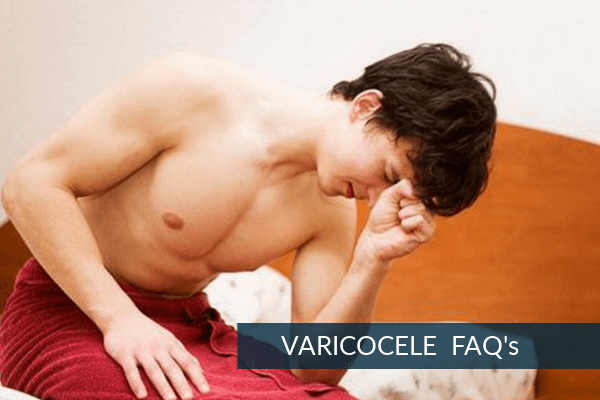 VARICOCELE-FAQs-  