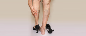 ec96a279-get-to-know-whats-triggering-varicose-veins-300x126  