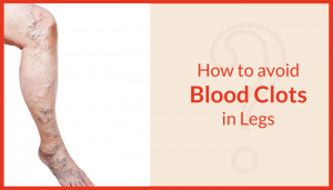 How-to-avoid-Blood-Clots-In-legs-300x171  