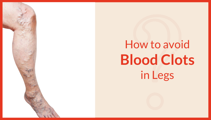 How-to-avoid-Blood-Clots-In-legs 