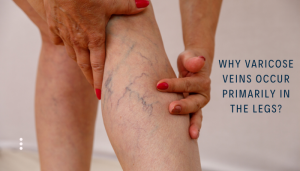 Varicose20veins20Treatment20-20Dr-300x171  