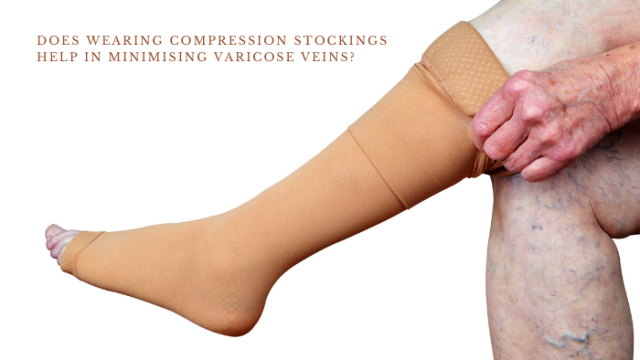 Does wearing compression stockings help in minimising varicose veins?