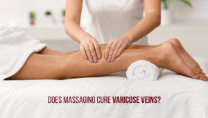 Massaging-legs-varicose-veins-300x171 