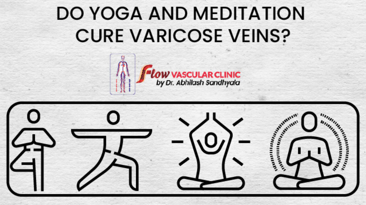 Yoga practice for healthy veins
