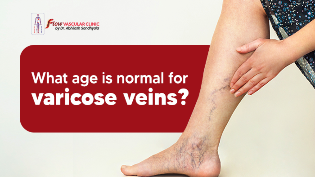 Venous insufficiency is a disease process which can affect all age