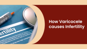 How-varicocele-causes-infertility-300x171  