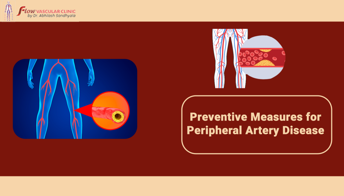 Preventive-measures-for-peripheral-artery-disease  