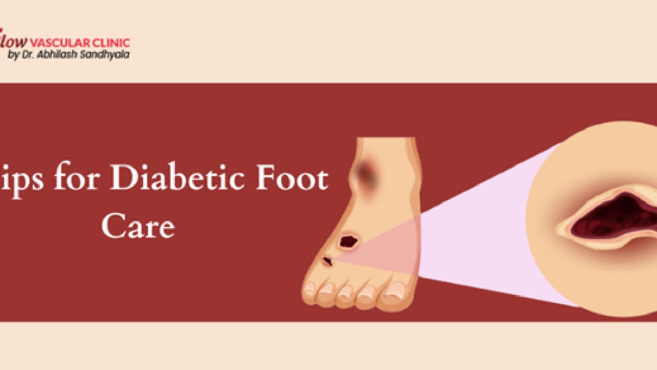 Diabetic Feet: Don't Risk Your Feet in Summer Heat: Hubert Lee, DPM:  Podiatrist