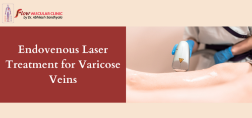 Endovenous Laser Treatment For Varicose Veins Dr Abhilash