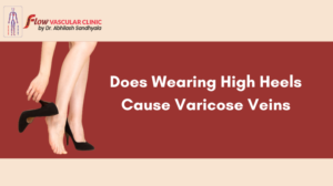 Does-Wearing-High-Heels-Cause-Varicose-Veins-300x168  