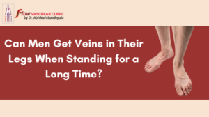 Can-Men-Get-Veins-in-Their-Legs-When-Standing-for-a-Long-Time-300x168  