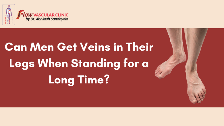 Can Men Get Veins in Their Legs When Standing for a Long Time