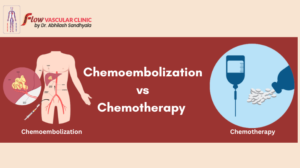 Chemoembolization-vs-Chemotherapy-300x168  