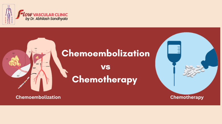 Chemoembolization vs Chemotherapy