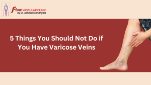 5-Things-You-Should-Not-Do-if-You-Have-Varicose-Veins-300x168  