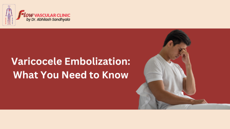 Varicocele Embolization What You Need To Know Dr Abhilash