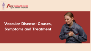 Vascular-Disease_-Causes-Symptoms-and-Treatment-300x168  